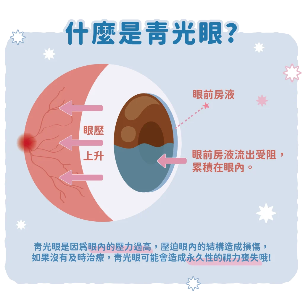 毛孩也會青光眼!林筱瑞獸醫師:這些品種愛注意!